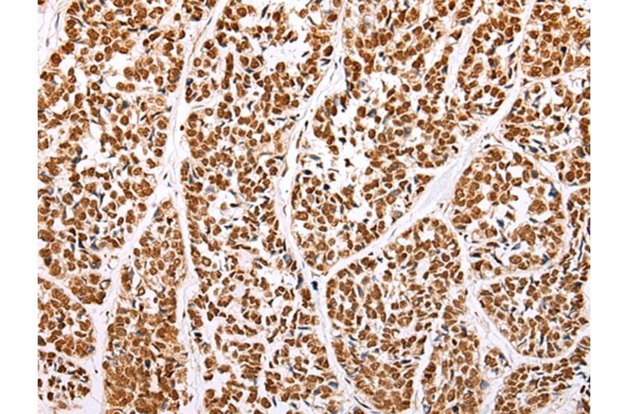 Immunohistochemistry - ABCA1 Antibody from Signalway Antibody (43463) - Antibodies.com