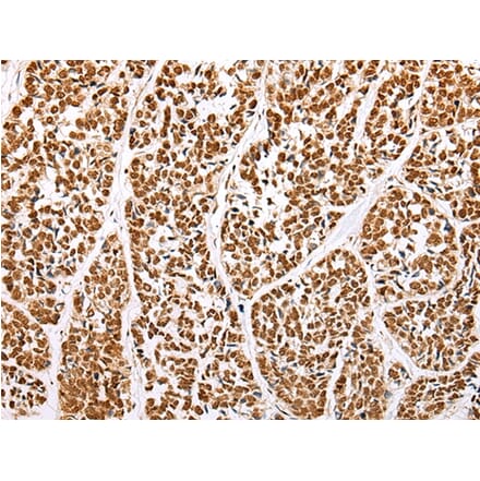 Immunohistochemistry - ABCA1 Antibody from Signalway Antibody (43463) - Antibodies.com