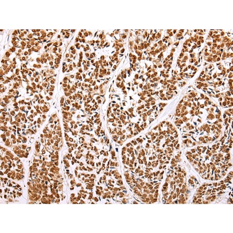 Immunohistochemistry - ABCA1 Antibody from Signalway Antibody (43463) - Antibodies.com