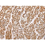 Immunohistochemistry - ABCA1 Antibody from Signalway Antibody (43463) - Antibodies.com