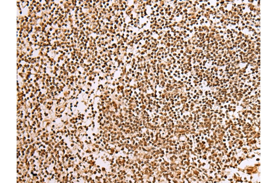 Immunohistochemistry - ABCA1 Antibody from Signalway Antibody (43463) - Antibodies.com