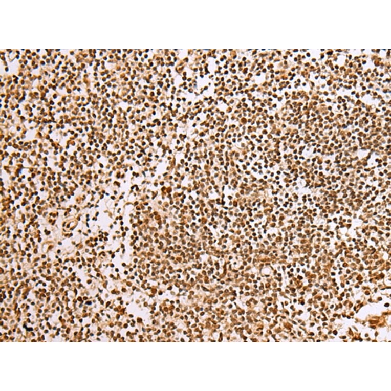 Immunohistochemistry - ABCA1 Antibody from Signalway Antibody (43463) - Antibodies.com
