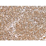 Immunohistochemistry - ABCA1 Antibody from Signalway Antibody (43463) - Antibodies.com