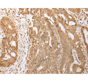 Immunohistochemistry - HDAC5 Antibody from Signalway Antibody (43465) - Antibodies.com