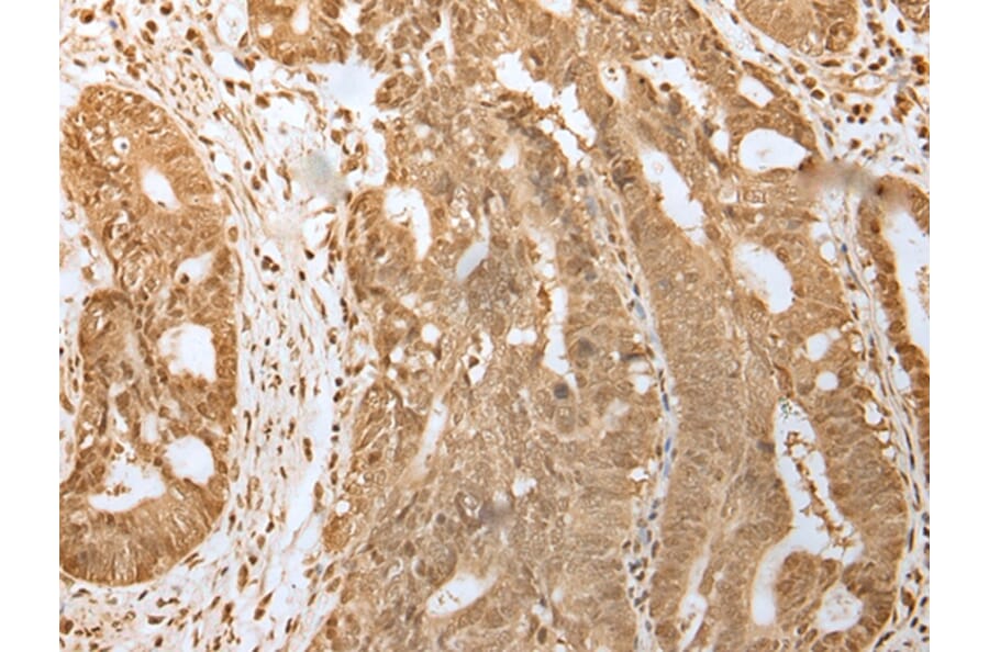 Immunohistochemistry - HDAC5 Antibody from Signalway Antibody (43465) - Antibodies.com