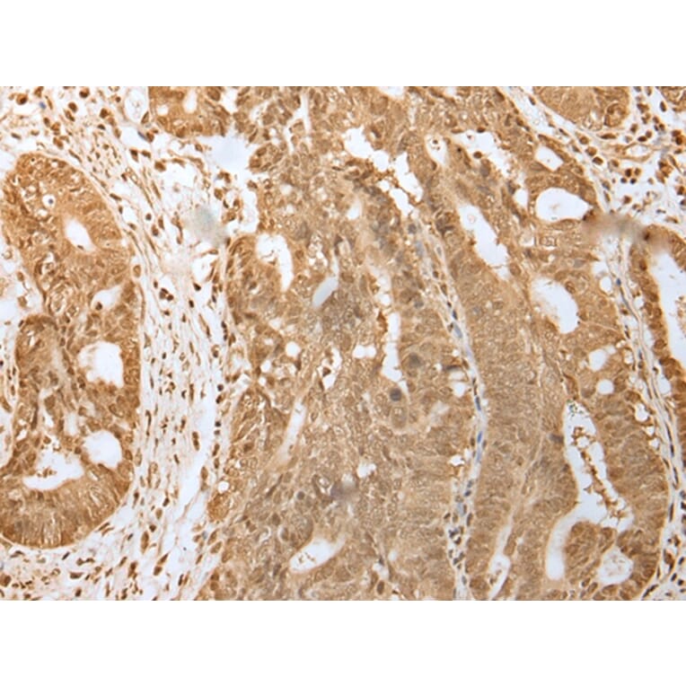 Immunohistochemistry - HDAC5 Antibody from Signalway Antibody (43465) - Antibodies.com