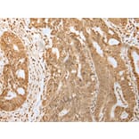 Immunohistochemistry - HDAC5 Antibody from Signalway Antibody (43465) - Antibodies.com