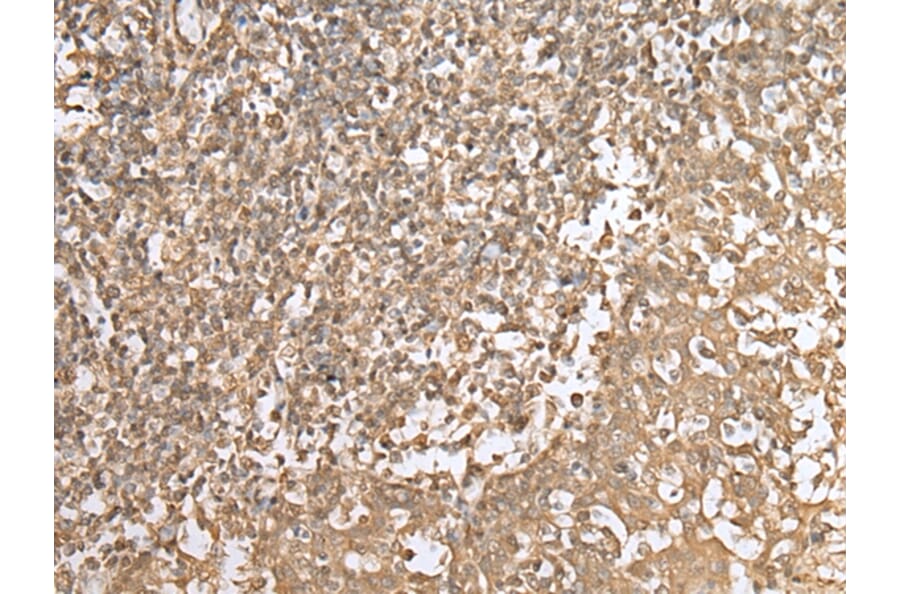Immunohistochemistry - HDAC5 Antibody from Signalway Antibody (43465) - Antibodies.com
