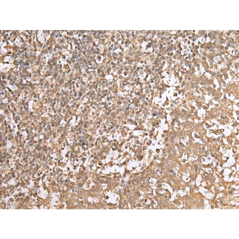 Immunohistochemistry - HDAC5 Antibody from Signalway Antibody (43465) - Antibodies.com