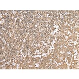 Immunohistochemistry - HDAC5 Antibody from Signalway Antibody (43465) - Antibodies.com