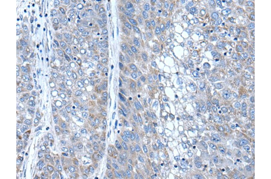 SFRP4 Antibody from Signalway Antibody (43506) - Antibodies.com