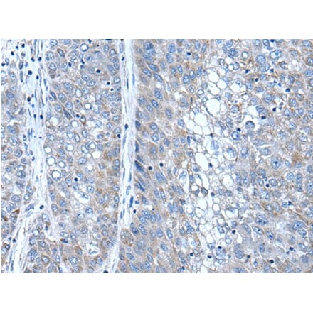 SFRP4 Antibody from Signalway Antibody (43506) - Antibodies.com