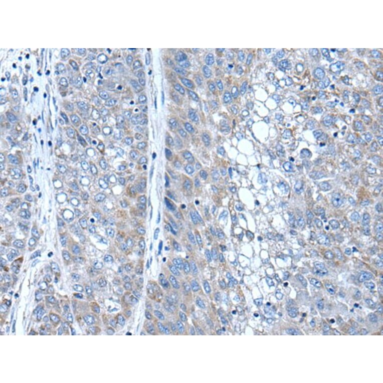 SFRP4 Antibody from Signalway Antibody (43506) - Antibodies.com