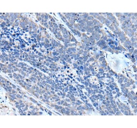 ITGA4 Antibody from Signalway Antibody (43510) - Antibodies.com