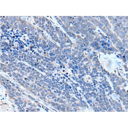 ITGA4 Antibody from Signalway Antibody (43510) - Antibodies.com