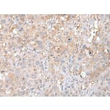 DEDD2 Antibody from Signalway Antibody (43513) - Antibodies.com