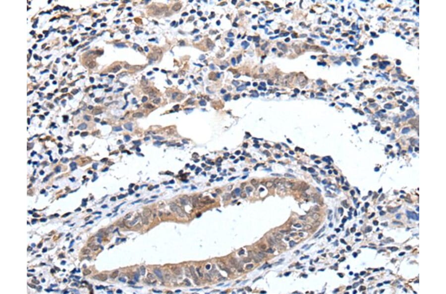 ELMO1 Antibody from Signalway Antibody (43515) - Antibodies.com