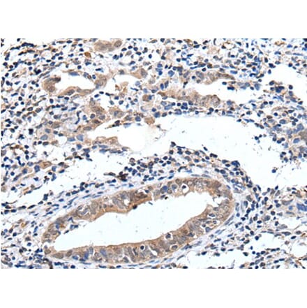 ELMO1 Antibody from Signalway Antibody (43515) - Antibodies.com