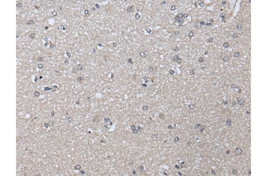 PRAME Antibody from Signalway Antibody (43525) - Antibodies.com