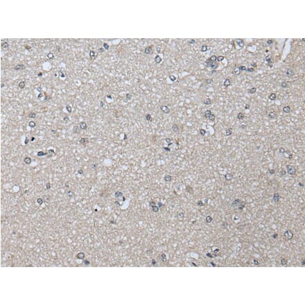 PRAME Antibody from Signalway Antibody (43525) - Antibodies.com