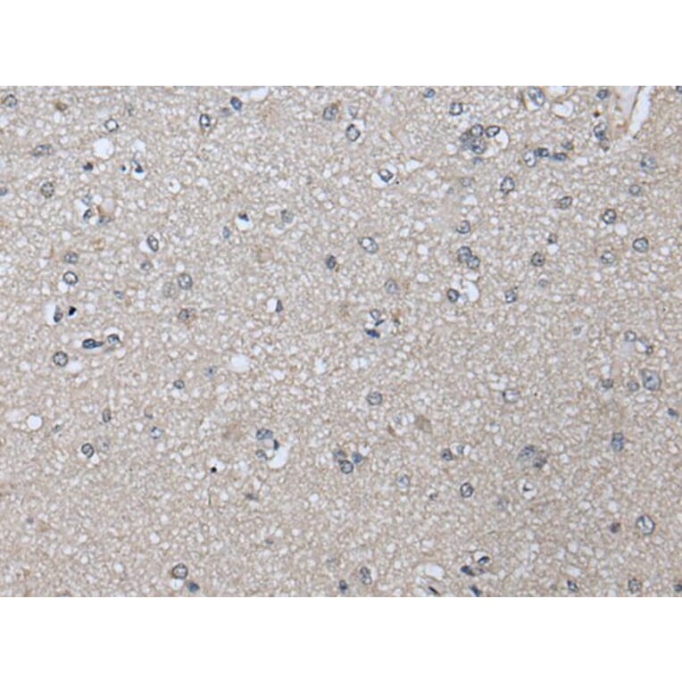 PRAME Antibody from Signalway Antibody (43525) - Antibodies.com