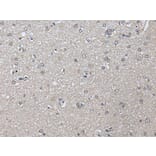 PRAME Antibody from Signalway Antibody (43525) - Antibodies.com