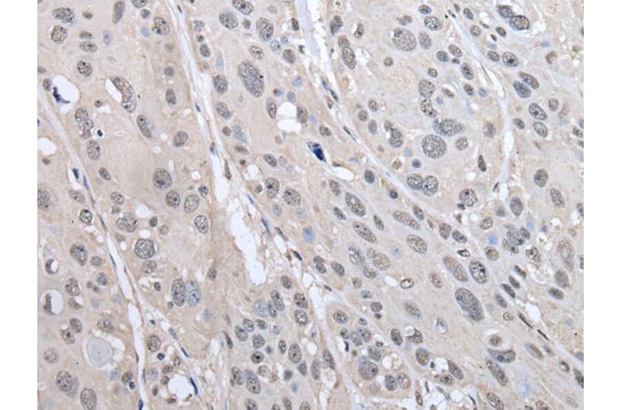 PRAME Antibody from Signalway Antibody (43525) - Antibodies.com