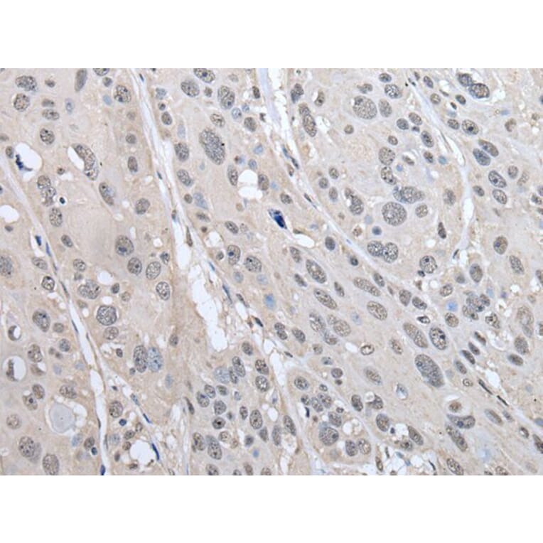 PRAME Antibody from Signalway Antibody (43525) - Antibodies.com