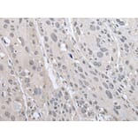 PRAME Antibody from Signalway Antibody (43525) - Antibodies.com