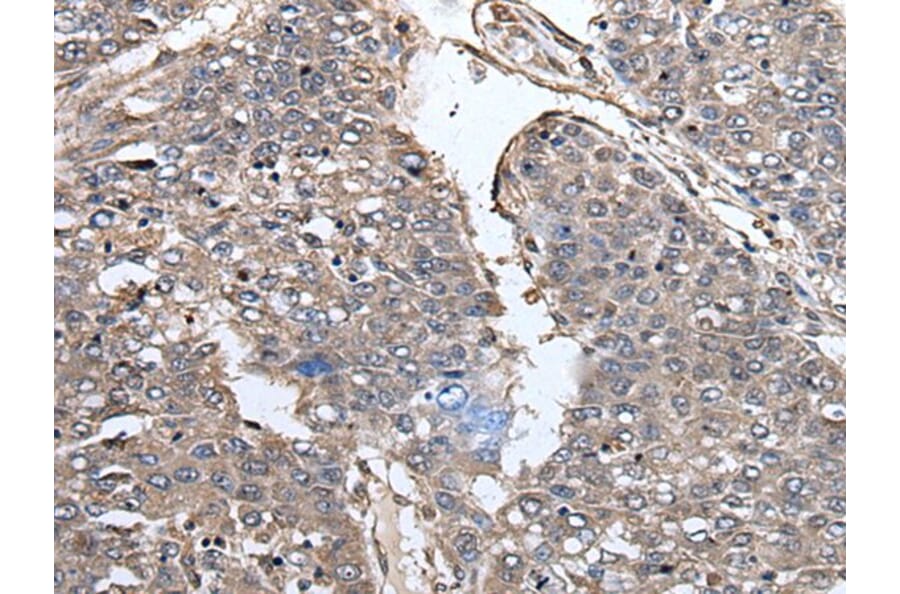 PRUNE Antibody from Signalway Antibody (43527) - Antibodies.com