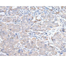 RASA1 Antibody from Signalway Antibody (43529) - Antibodies.com