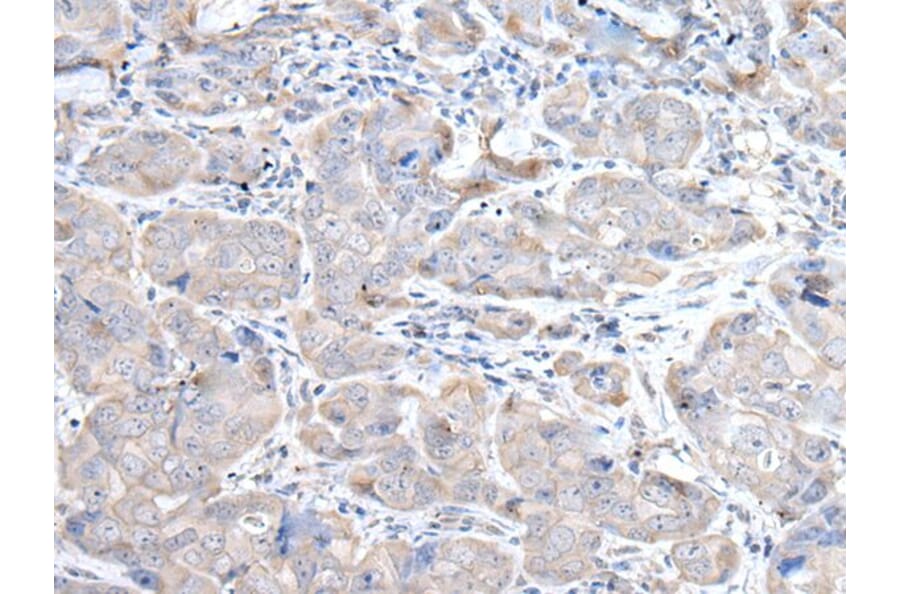 RASA1 Antibody from Signalway Antibody (43529) - Antibodies.com