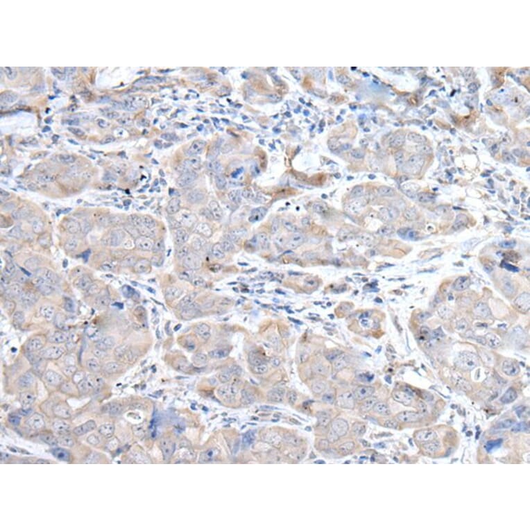 RASA1 Antibody from Signalway Antibody (43529) - Antibodies.com