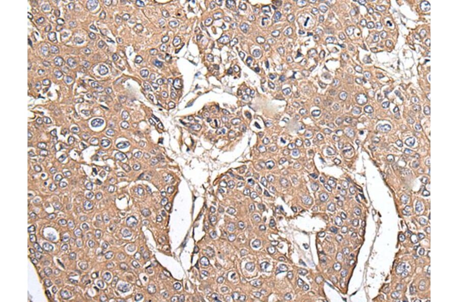 KRT73 Antibody from Signalway Antibody (43544) - Antibodies.com
