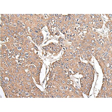 KRT73 Antibody from Signalway Antibody (43544) - Antibodies.com