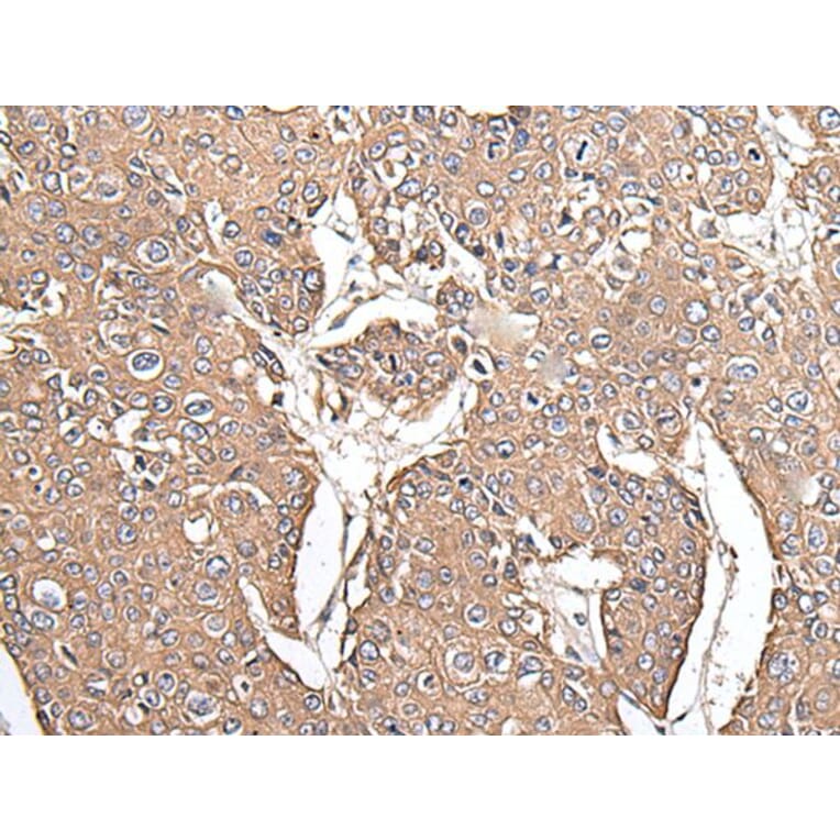 KRT73 Antibody from Signalway Antibody (43544) - Antibodies.com