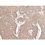 KRT73 Antibody from Signalway Antibody (43544) - Antibodies.com