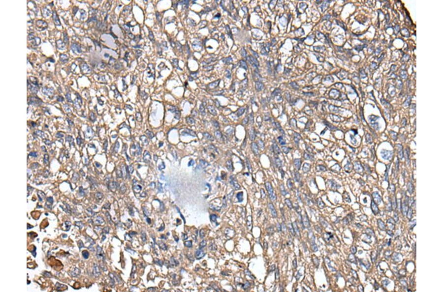 KRT73 Antibody from Signalway Antibody (43544) - Antibodies.com