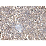 KRT73 Antibody from Signalway Antibody (43544) - Antibodies.com