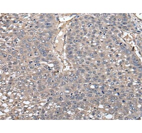 GCNT2 Antibody from Signalway Antibody (43547) - Antibodies.com
