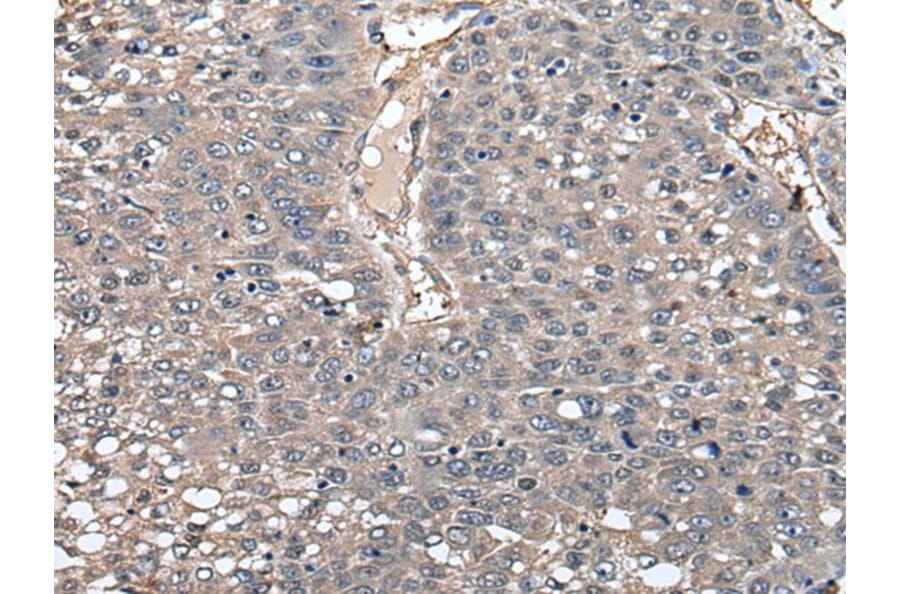 GCNT2 Antibody from Signalway Antibody (43547) - Antibodies.com