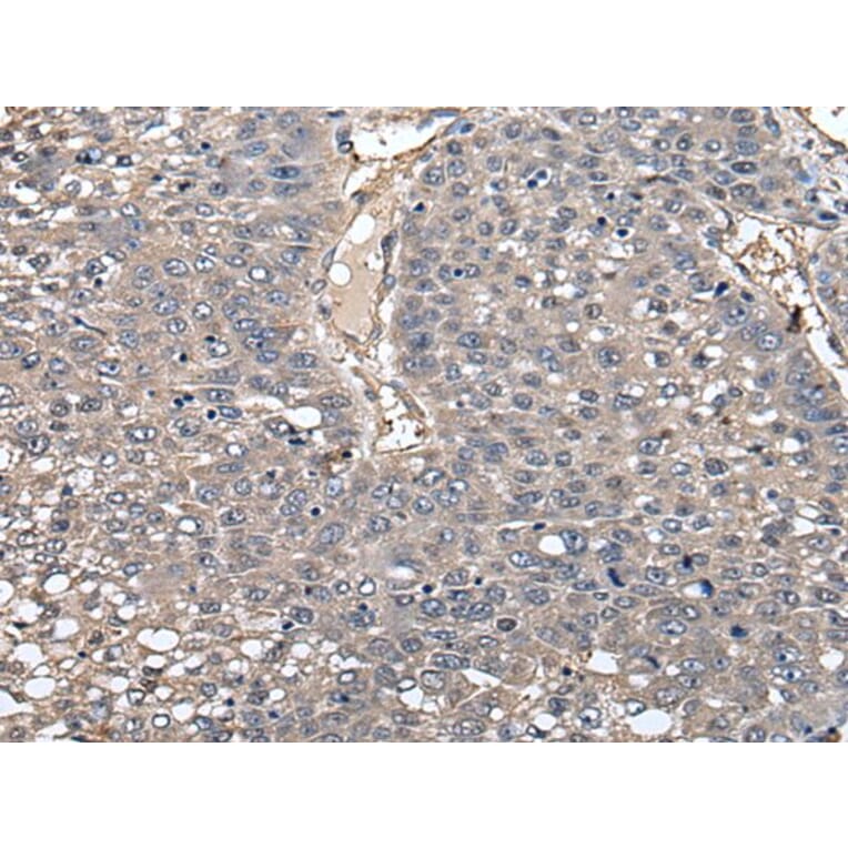 GCNT2 Antibody from Signalway Antibody (43547) - Antibodies.com