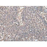 GCNT2 Antibody from Signalway Antibody (43547) - Antibodies.com
