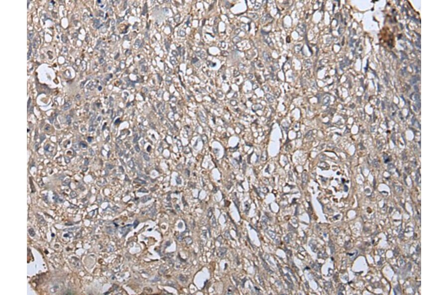 RUFY4 Antibody from Signalway Antibody (43548) - Antibodies.com