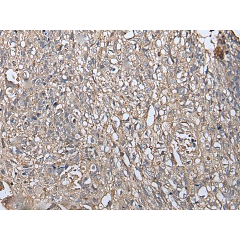 RUFY4 Antibody from Signalway Antibody (43548) - Antibodies.com