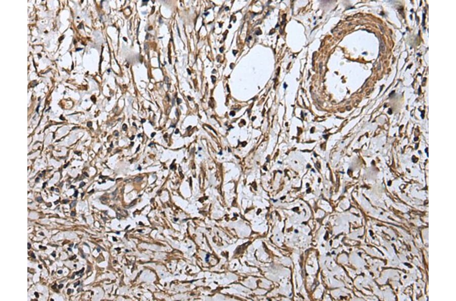 RUFY4 Antibody from Signalway Antibody (43548) - Antibodies.com