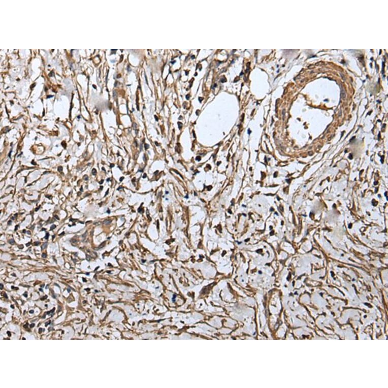 RUFY4 Antibody from Signalway Antibody (43548) - Antibodies.com