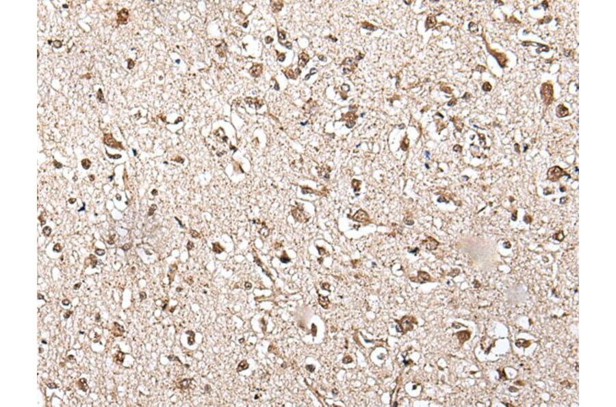 ZFP36 Antibody from Signalway Antibody (43567) - Antibodies.com