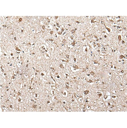 ZFP36 Antibody from Signalway Antibody (43567) - Antibodies.com