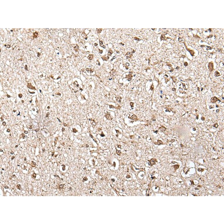 ZFP36 Antibody from Signalway Antibody (43567) - Antibodies.com